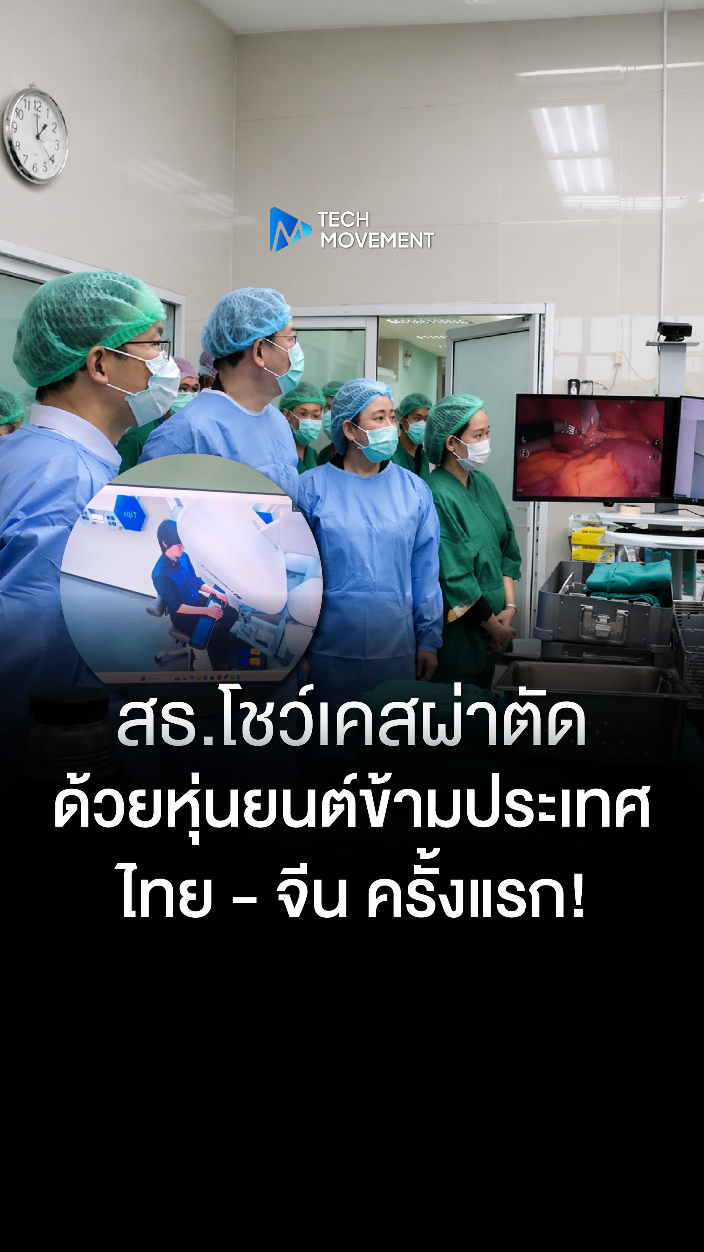 สธ โชว์เคสผ่าตัดด้วยหุ่นยนต์ผ่าตัดข้ามประเทศไทย จีน ครั้งแรก