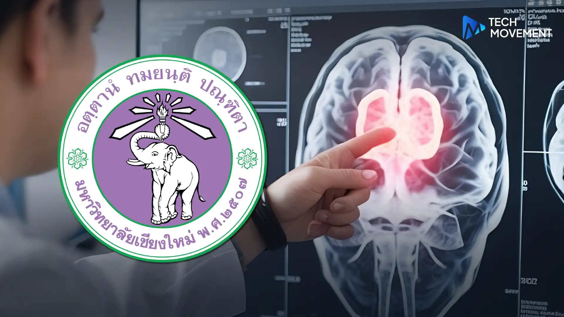 มช.พัฒนา_AI_ช่วยวินิจฉัยเนื้องอกในสมอง_แม่นยำถึง_97%.webp