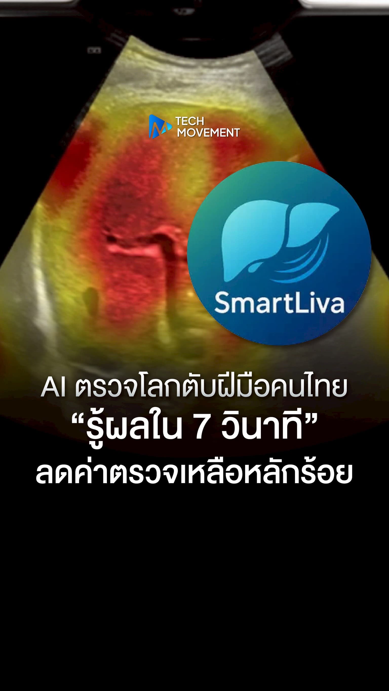 AI ตรวจโรคตับฝีมือคนไทย รู้ผลใน 7 วินาที ลดค่าตรวจเหลือหลักร้อย