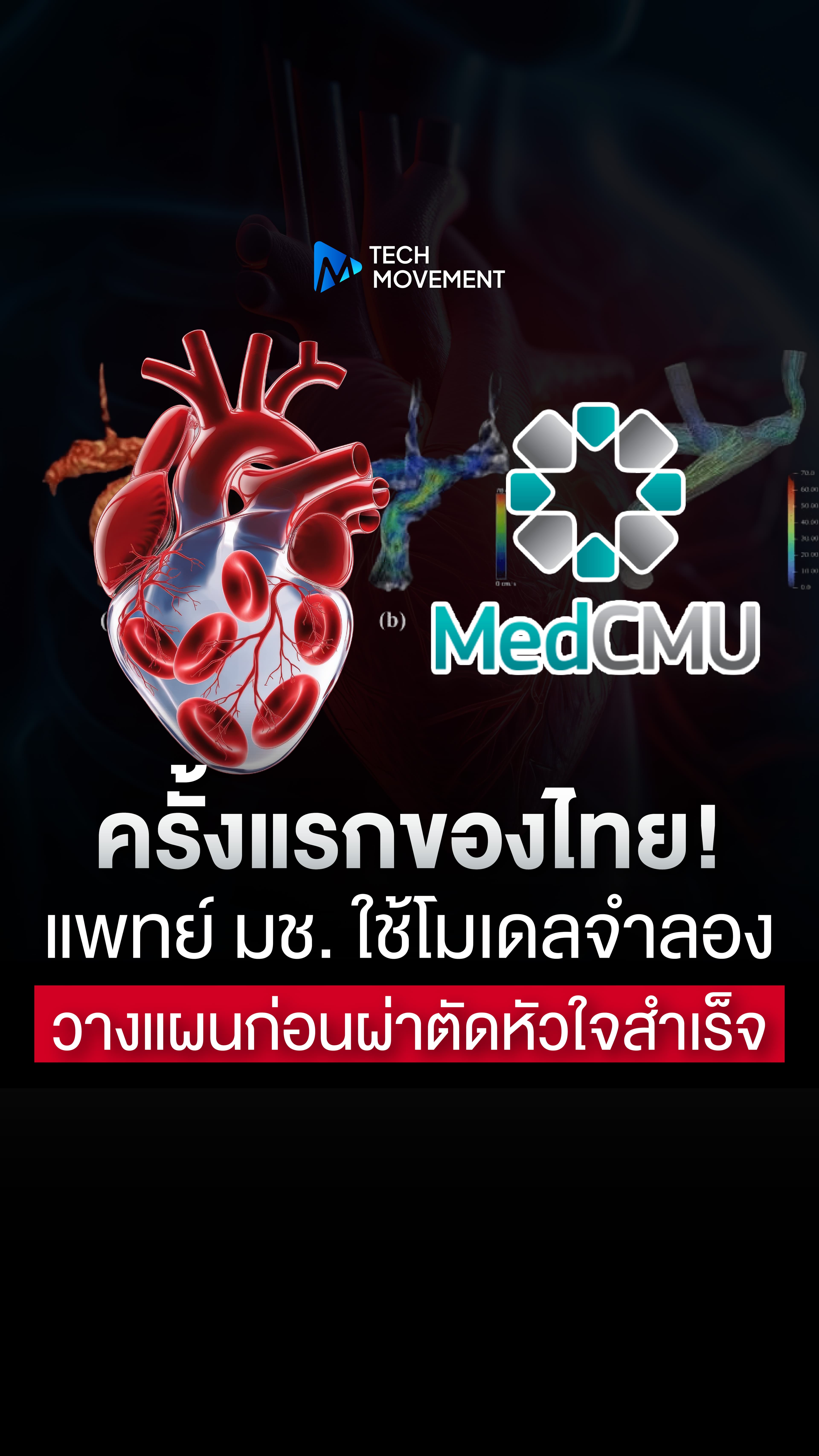 แพทย์ มช ใช้โมเดลจำลอง วางแผนก่อนผ่าตัดหัวใจสำเร็จครั้งแรกของไทย
